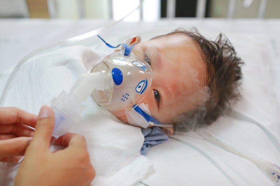 Inhalation baby boy age about 1 years old on patient bed. Respiratory Syncytial Virus (RSV). Intensive care on bed at hospital.